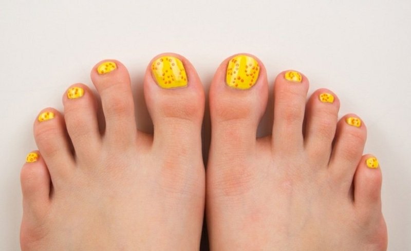 Dipingi le unghie dei piedi in giallo sole